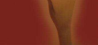 Valentina Lerro Fischer chirurgo plastico